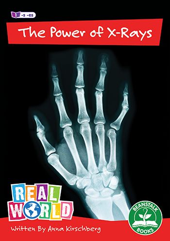 The Power of X-Rays